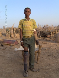 Tekle, a landmine survivor from Ethiopia